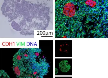 Mit künstlichen Organen Krebstherapie verbessern
