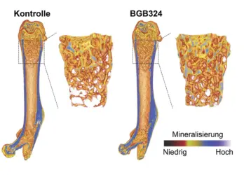 Neuer Ansatzpunkt für Behandlung von Osteoporose